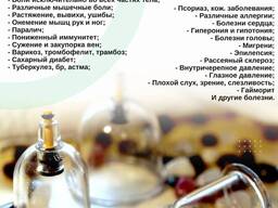 Хиджама в Бишкеке