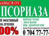 ПСОРИАЗ! Найден новый и эффективный способ лечения - фото 1